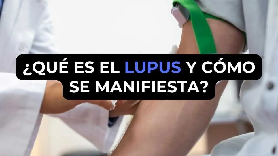 ¿Qué es el lupus y cómo se manifiesta?